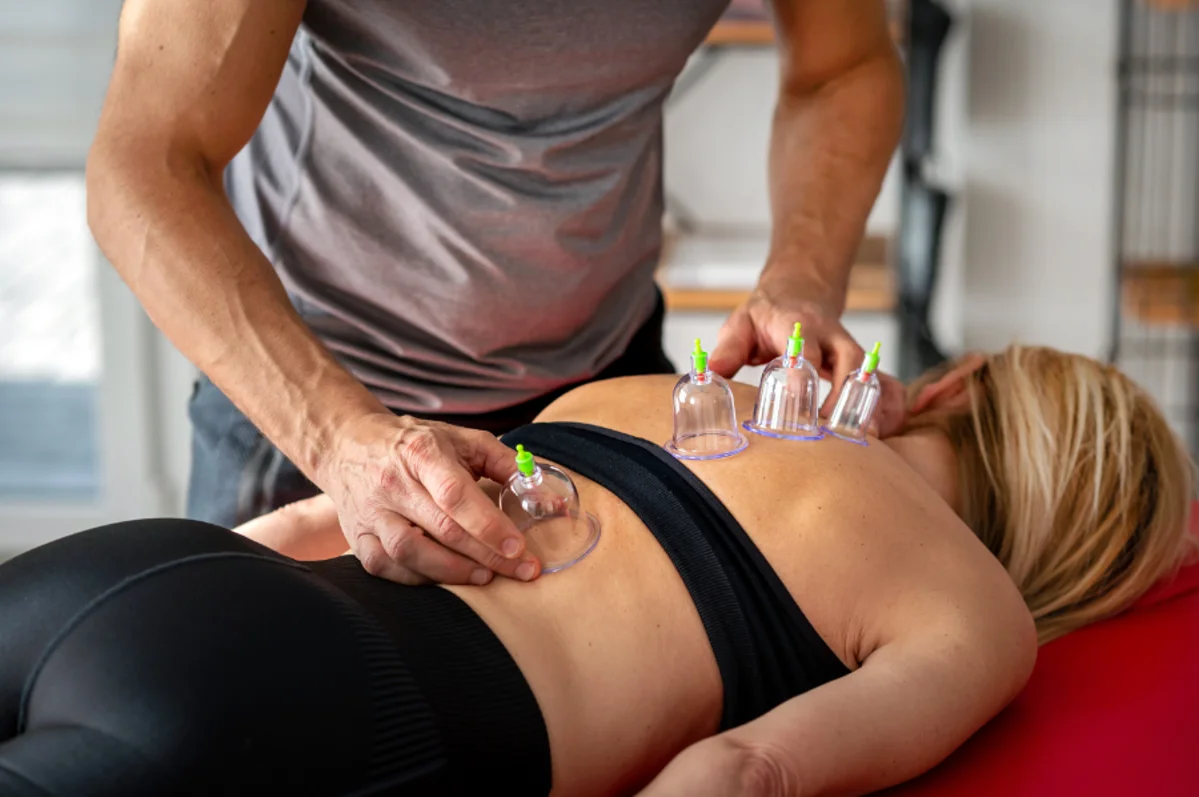 4 Reasons Cupping Therapy Can Aid in Recovery