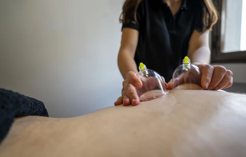 5 Questions to Ask Prior to Cupping Therapy