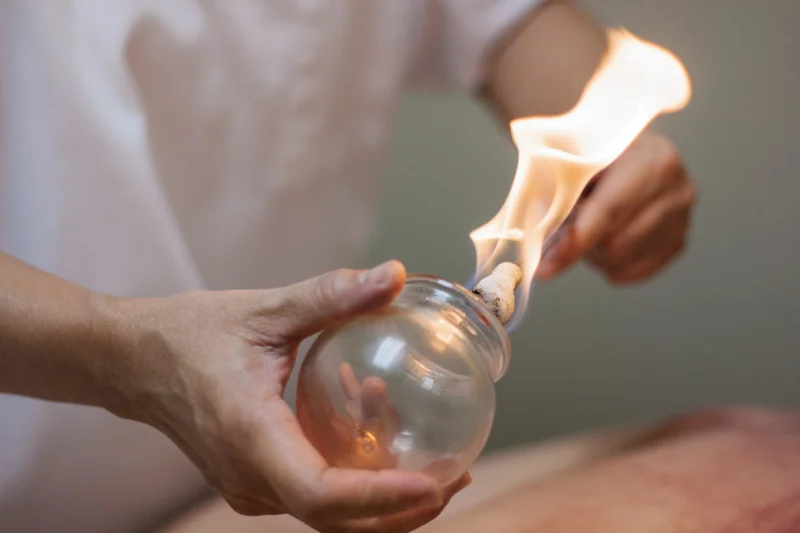 Addressing Severe Stagnation in Cupping Therapy
