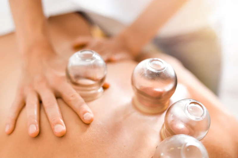 Who Needs Cupping Therapy?